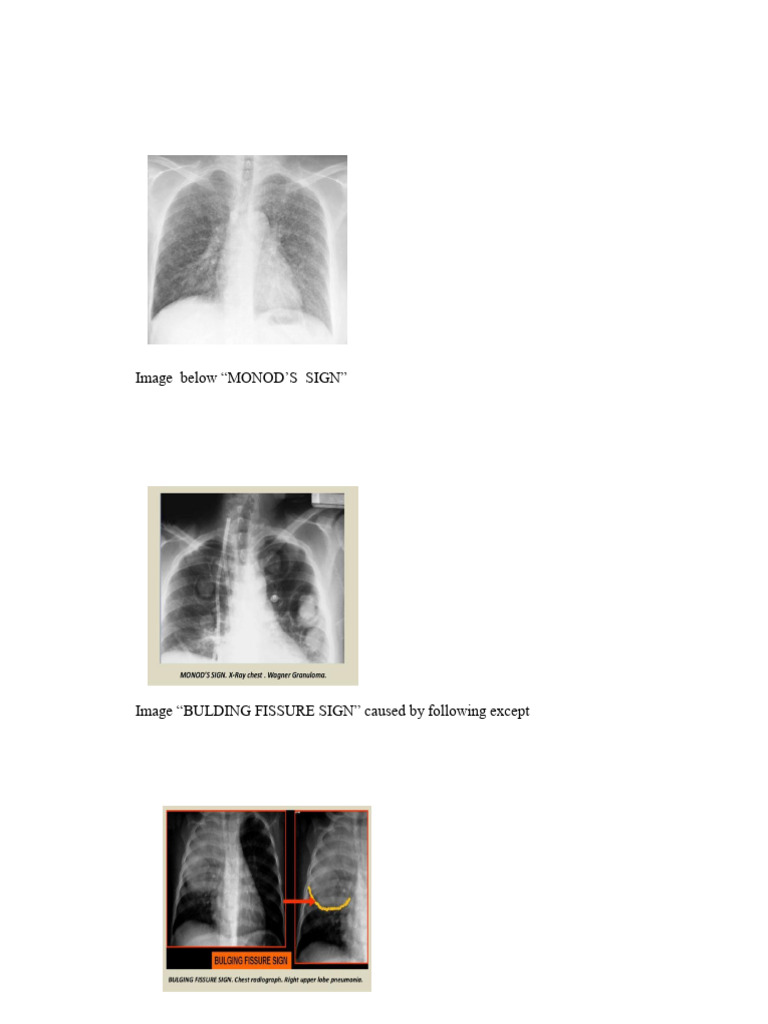 Radiology 3rd 60 Multiple Choice Qs 05 | PDF | Congenital Heart Defect ...