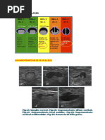 Clasificacion de Bedi | PDF | Ultrasonido médico | Especialidades Medicas