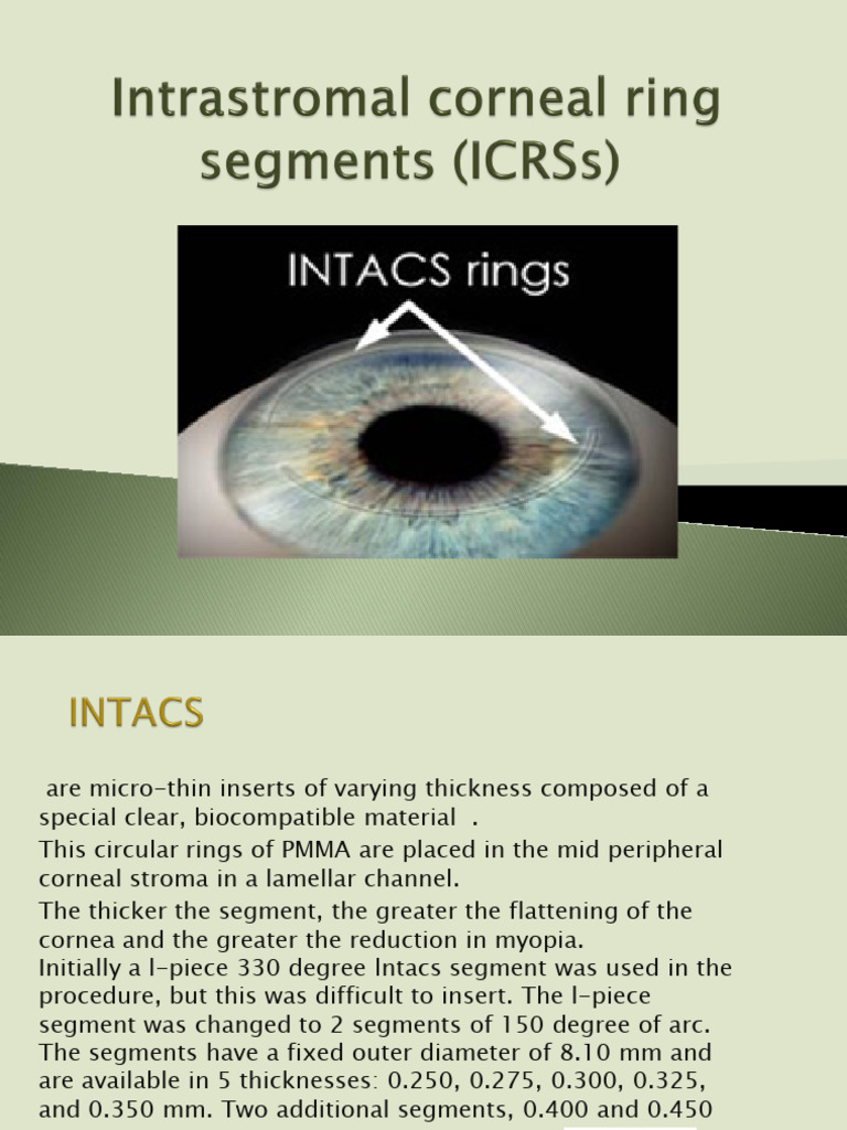 Intacspower 190802092639 | PDF | Cornea | Myopia