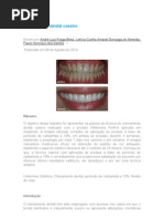 Clareamento dental caseiro - Artigo