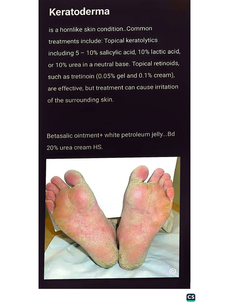 Keratoderma Pdf 