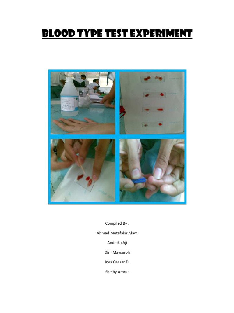 Blood Type Test Experiment Blood Type Pathology