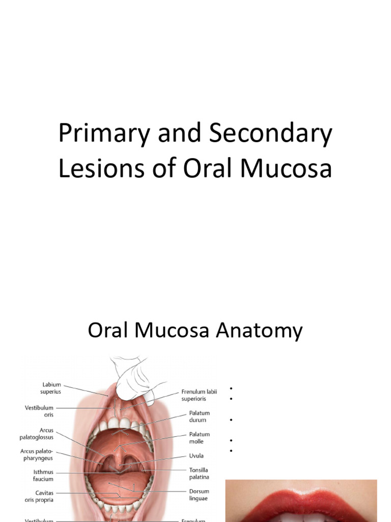 Oral Cavity Lesions Overview | PDF | Epithelium | Tongue