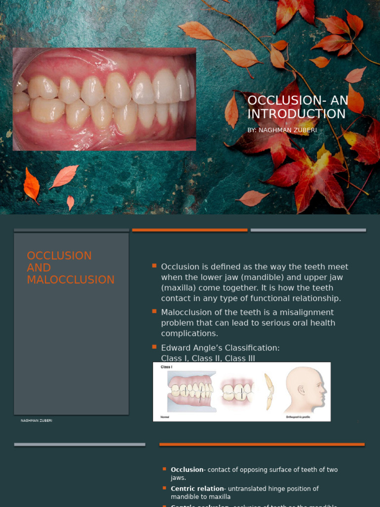 Understanding Occlusion and Malocclusion | PDF | Dentistry | Dental Anatomy