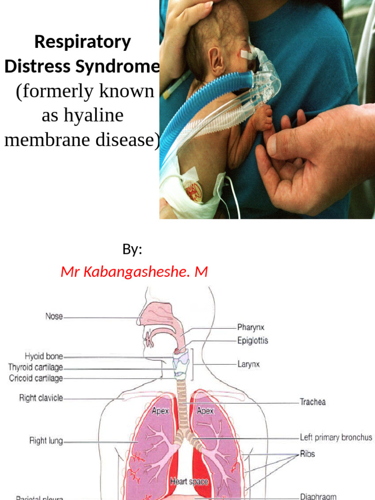 Respiratory Distress Syndrome-1 | PDF | Lung | Respiratory System