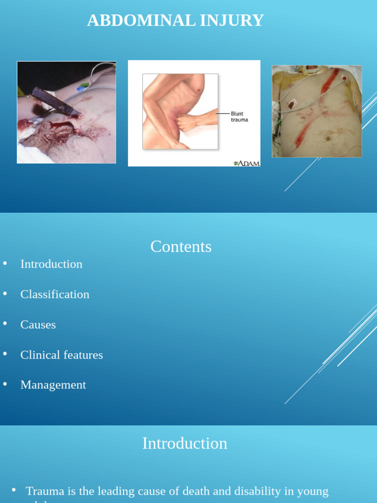 Abd Injury (1) | PDF | Abdomen | Major Trauma