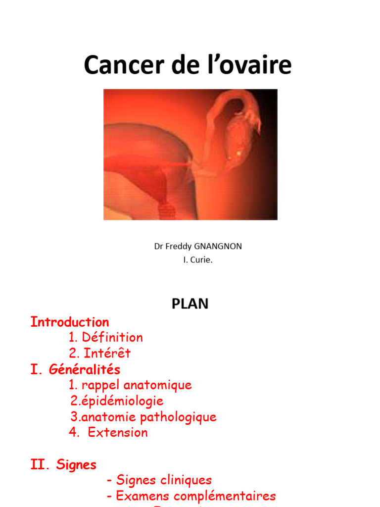 Comprendre le cancer de l'ovaire PDF Cancer de l'ovaire Médecine — free download