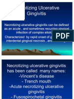 Necrotizing Ulcerative Gingivitis