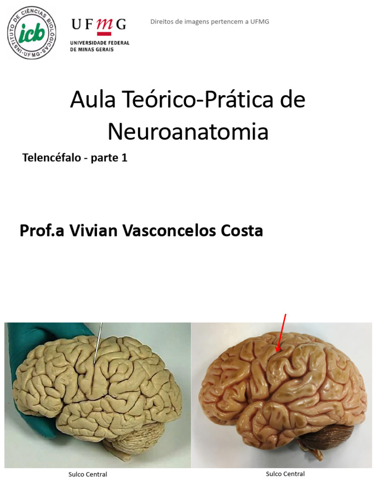 Telencefalo VVC | PDF