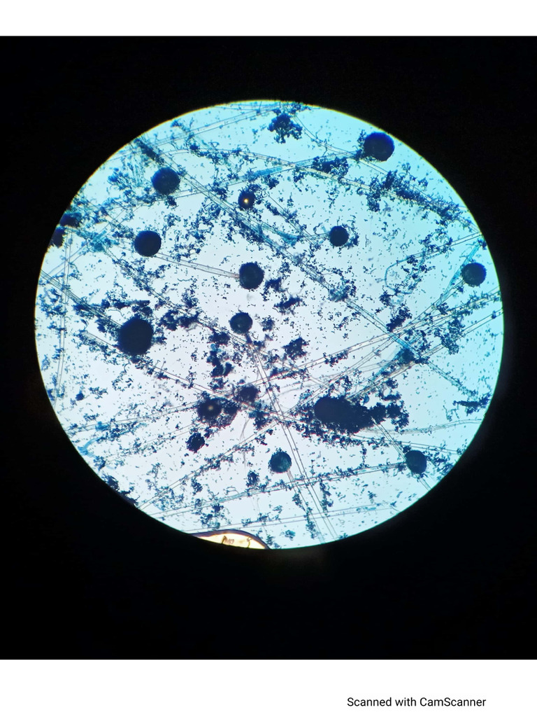 Micro Spots | PDF