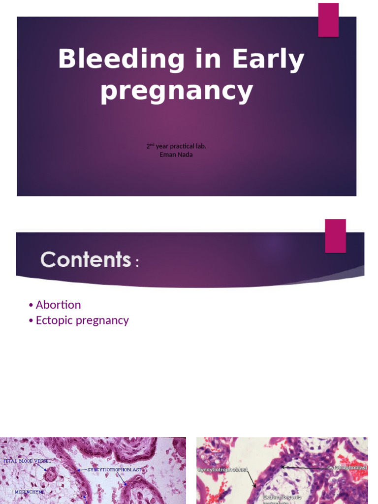 Early Pregnancy Bleeding Lab Analysis | PDF