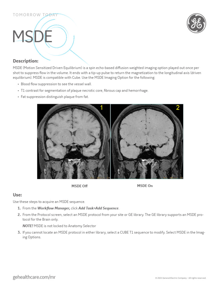 MSDE Imaging Protocol for MRI | PDF | Magnetic Resonance Imaging ...