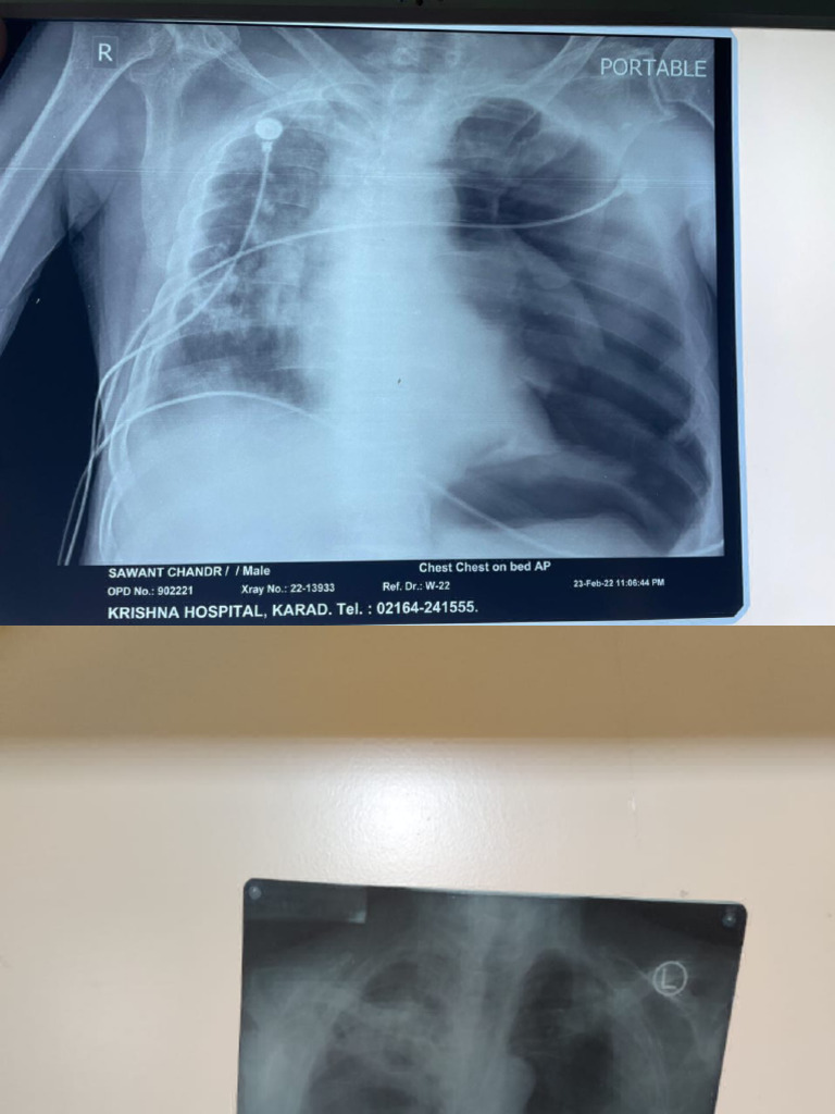 XRAYS | PDF