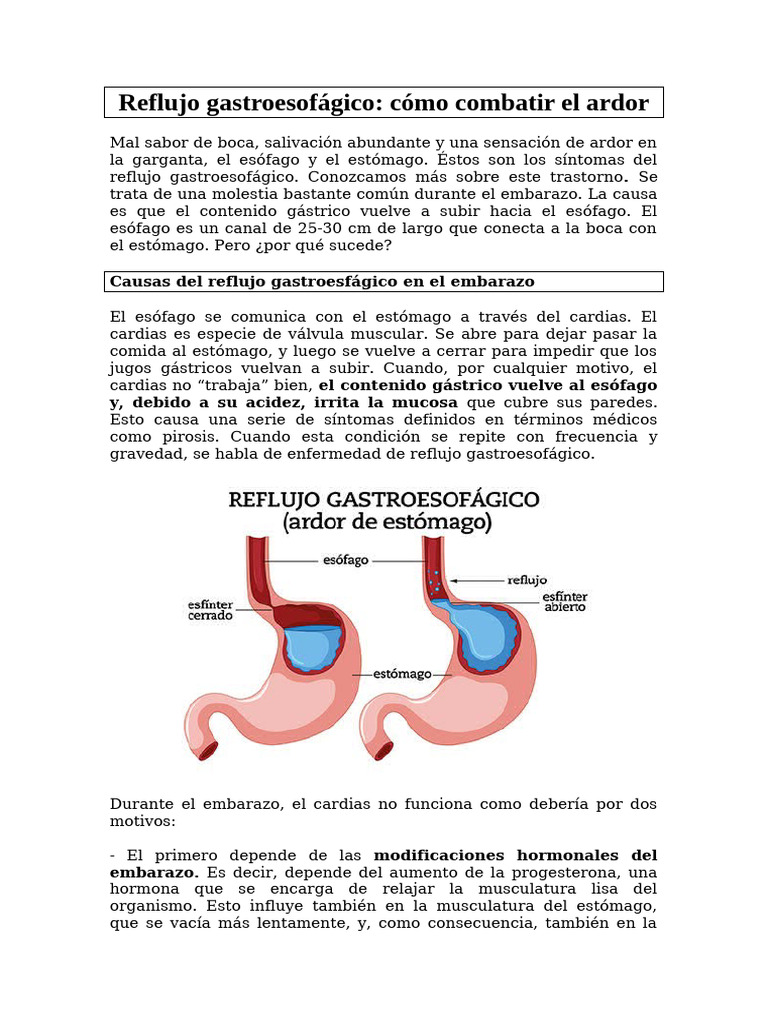 Reflujo gastroesofágico | PDF | La enfermedad por reflujo ...