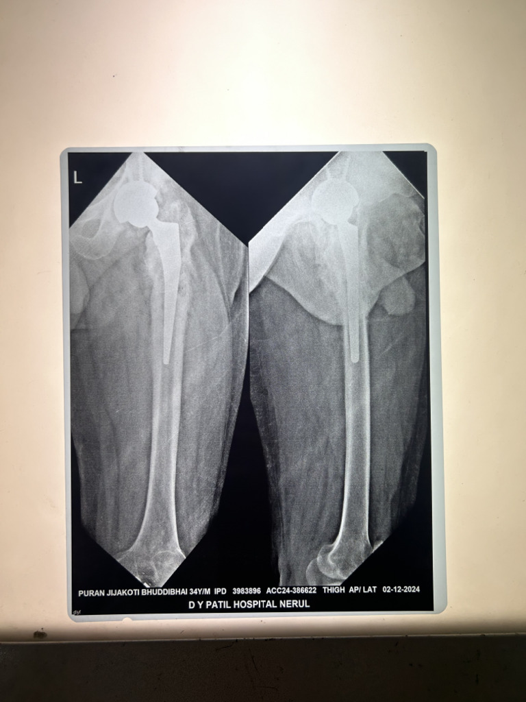 X Ray | PDF