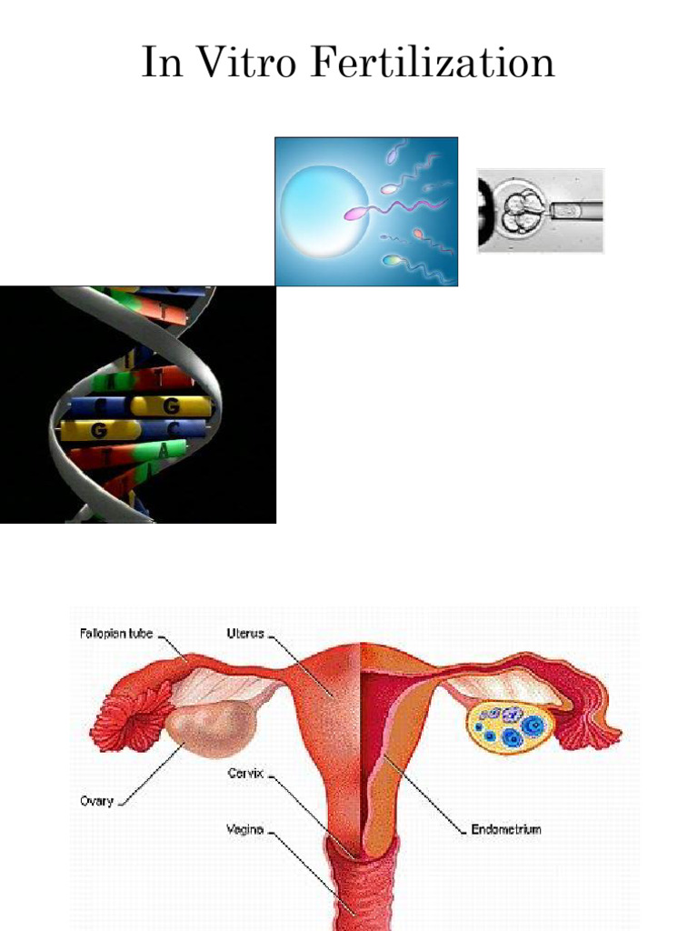305-7 | PDF | In Vitro Fertilisation | Fertilisation