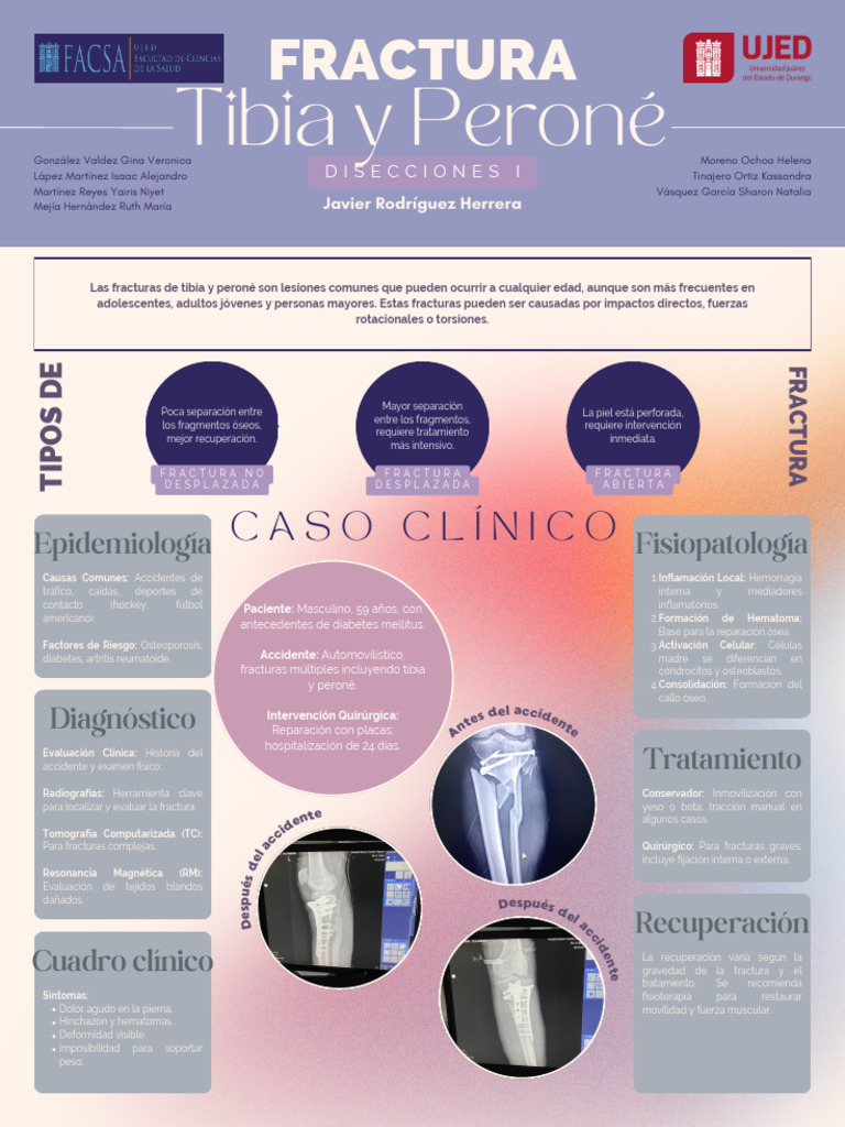 Cartel Fractura Tibia y Perone | PDF | Hueso | Osteoporosis