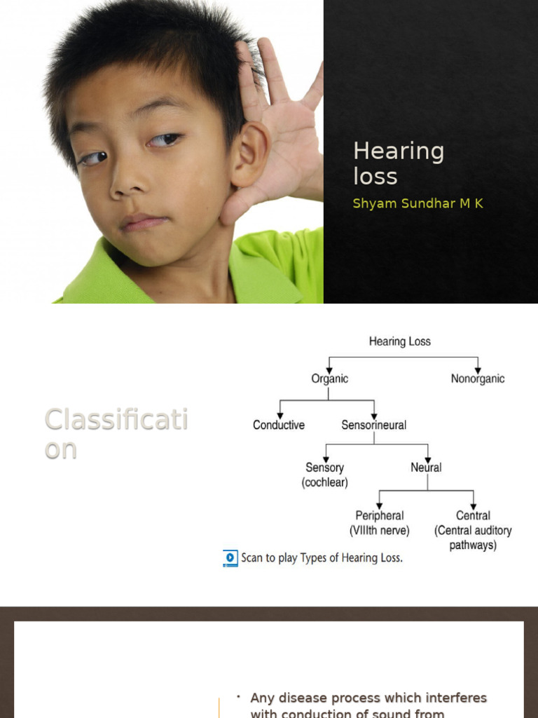 Hearing Loss Pdf Hearing Loss Ear