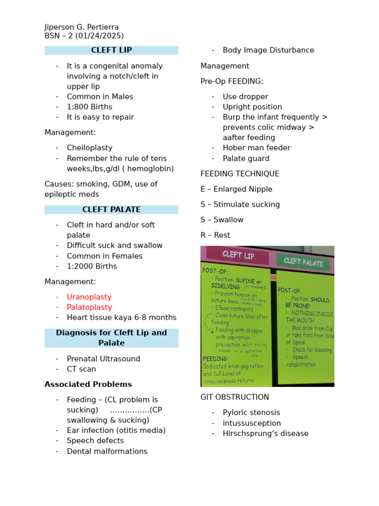 Cleft Lip and Palate Overview | PDF