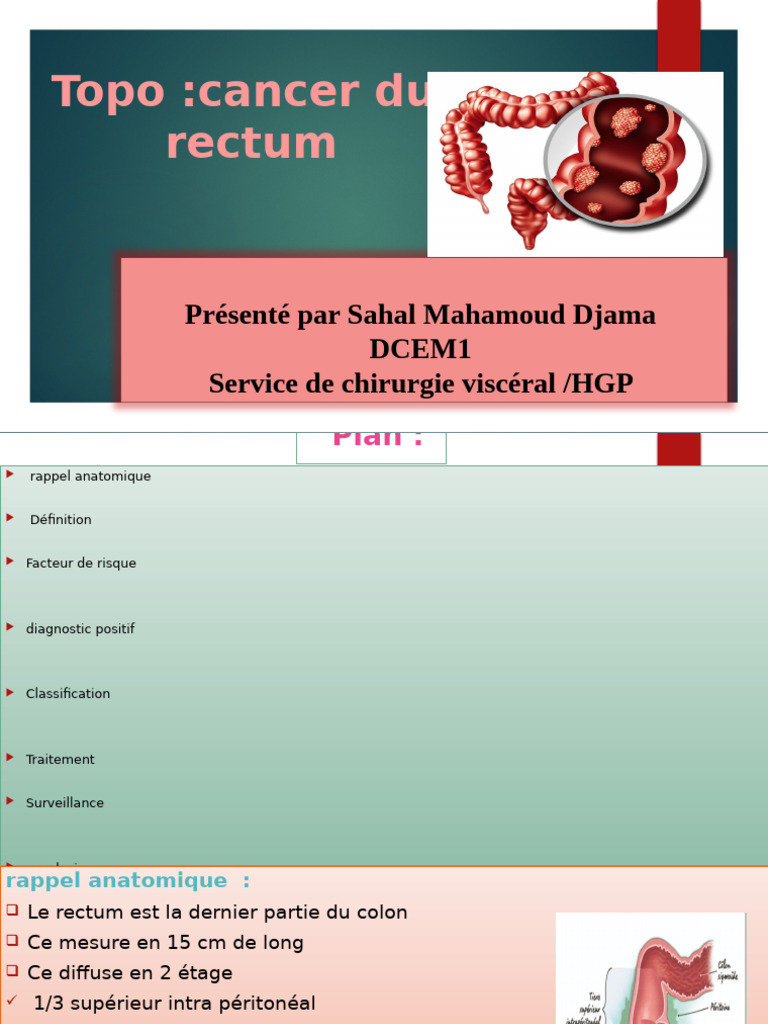 Tumeur de Rectum Sahal | PDF | Cancer du côlon | Rectum