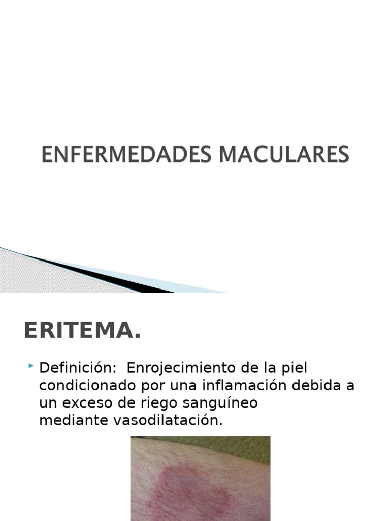 enfermedades-maculares-pdf-piel-especialidades-medicas