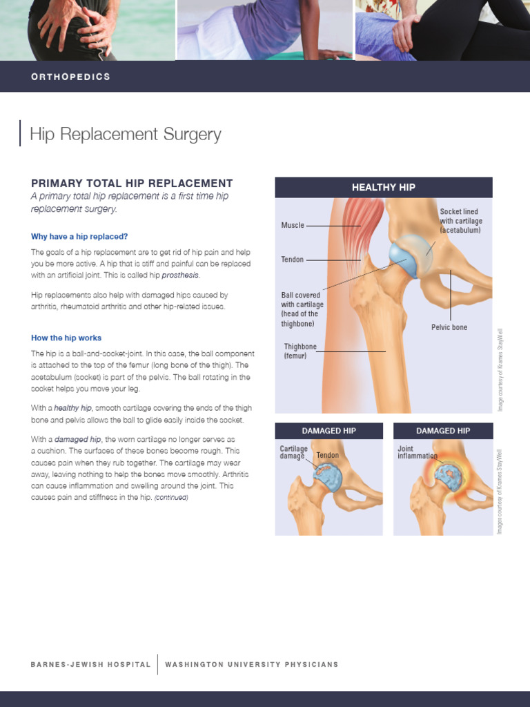 Total Hip Replacement Overview | PDF | Hip | Medical Specialties