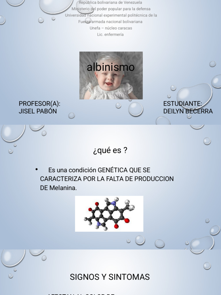 Albinism o | PDF