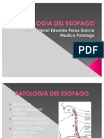Patologia Del Esofago