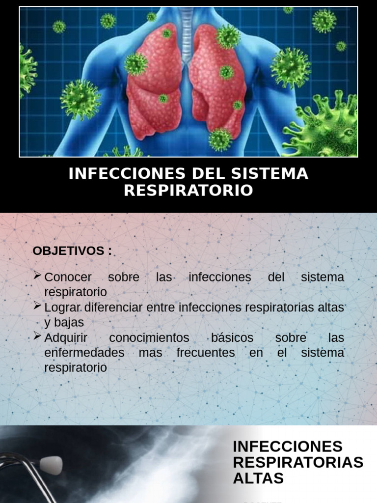 Infecciones del Sistema Respiratorio | PDF