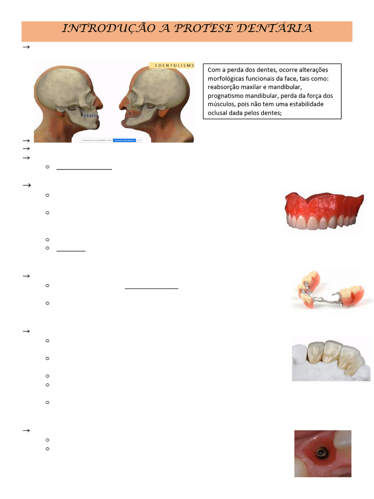 tipos-de-pr-tese-dent-ria-e-fun-es-pdf