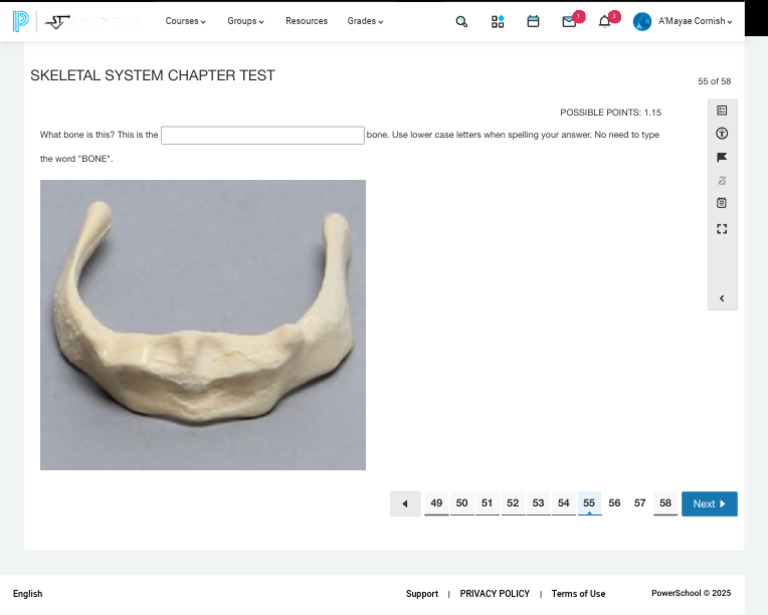 Skeletal System Test Overview | PDF