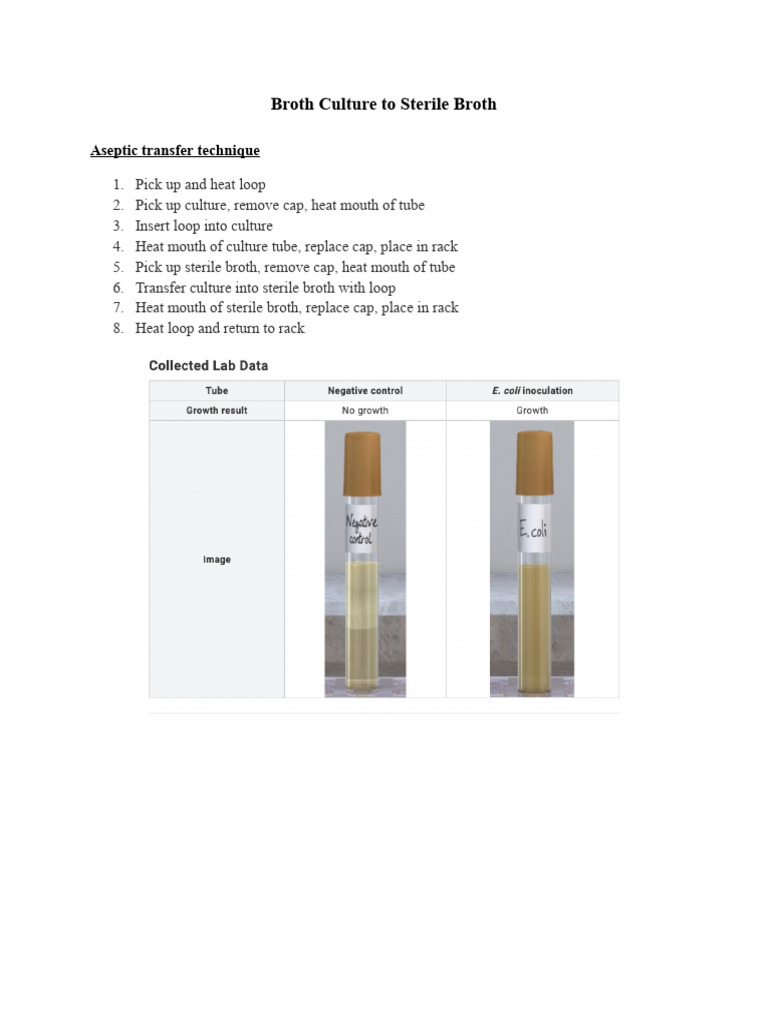 Aseptic Transfer For Broth Culture Pdf