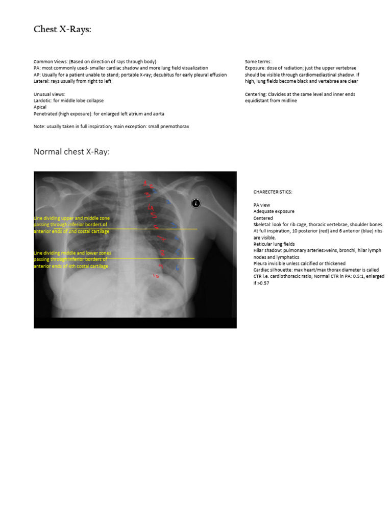 Chest X-Rays_merged | PDF | Lung | Heart