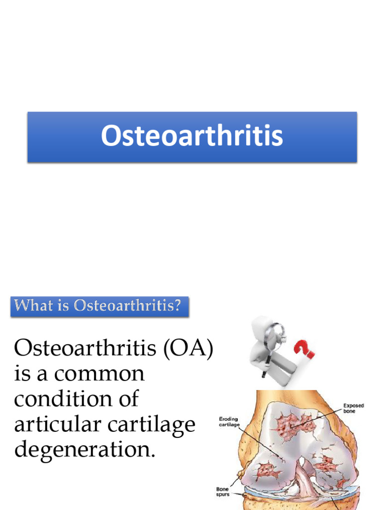 Understanding Osteoarthritis: Causes & Treatments | PDF ...