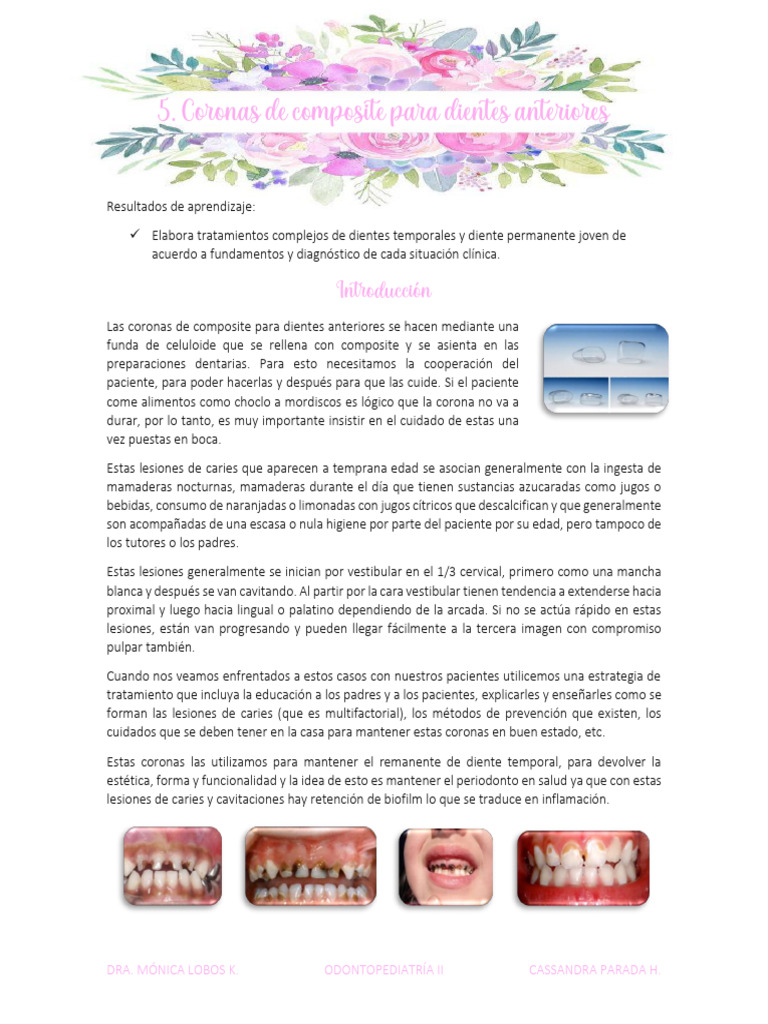 Coronas de Composite en Odontopediatría | PDF | Diente humano | Esmalte ...
