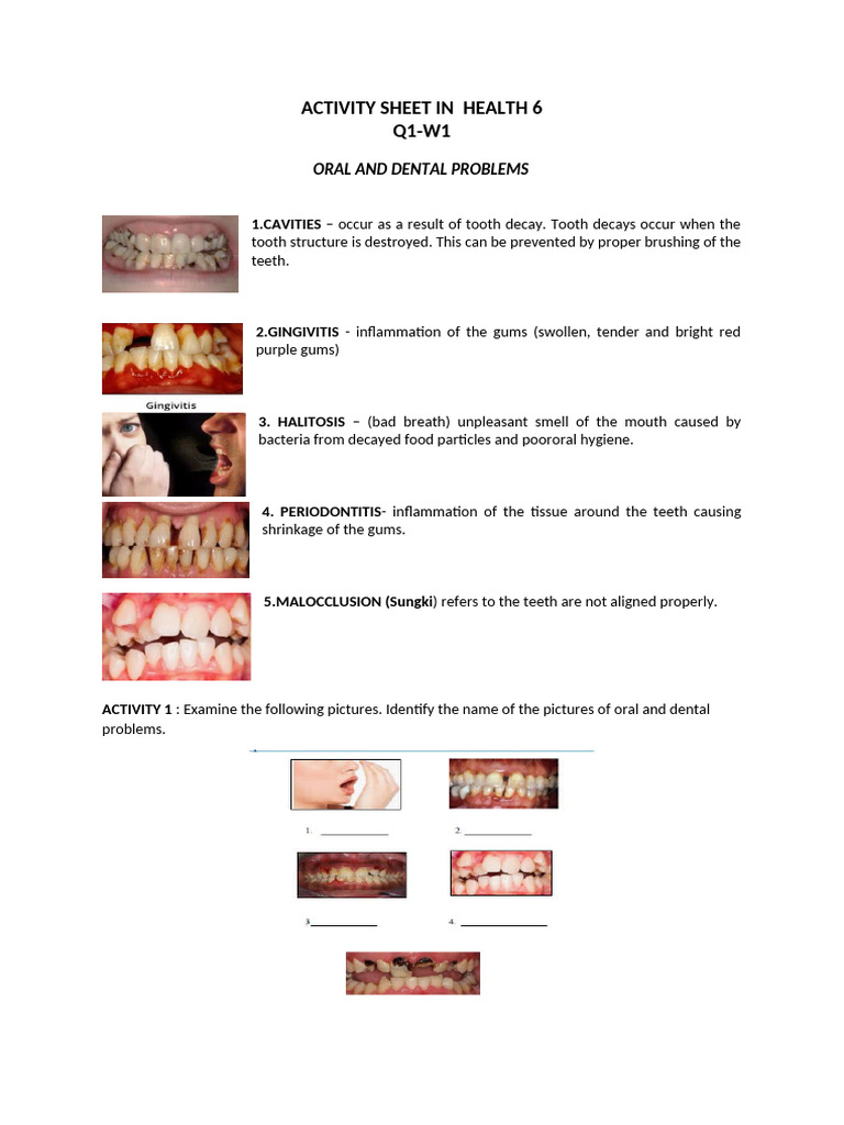 Oral and Eye Health Issues for Kids | PDF | Eye | Ophthalmology