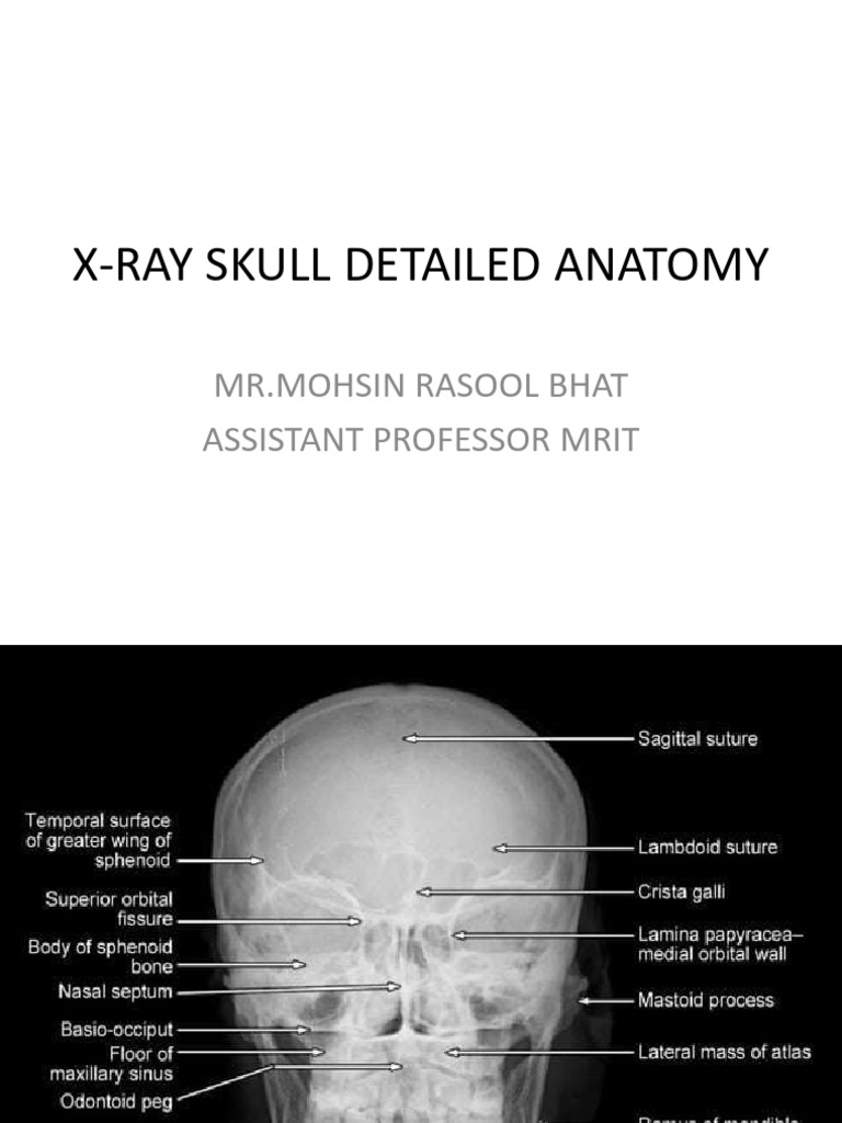 Skull Anatomy Brief | PDF