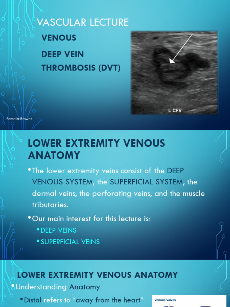 Deep Vein Thrombosis Overview and Anatomy | PDF | Vein | Angiology