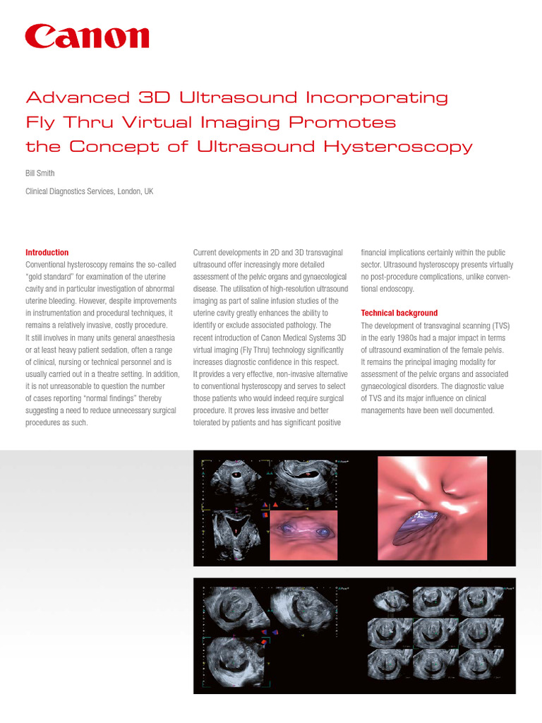 WP-C-Advanced 3D Fly Thru Virtual Imaging Promotes the Concept ...