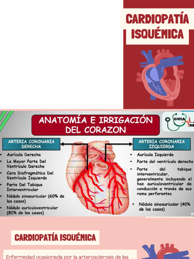 SICA, IAM Y ANGINA DE PECHO | PDF | Infarto de miocardio | Isquemia