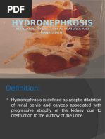 Understanding Hydronephrosis in Radiology | PDF | Urinary System ...
