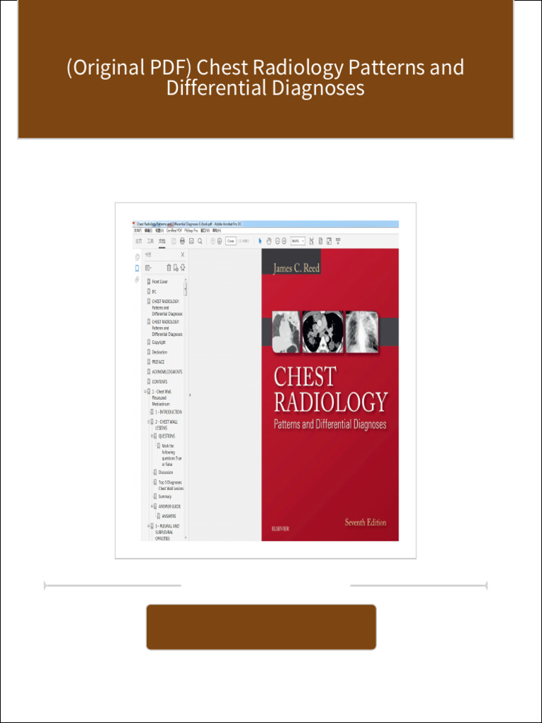 (Original PDF) Chest Radiology Patterns and Differential Diagnoses ...