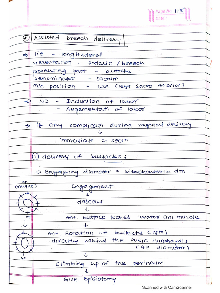 Assisted Breech Delivery 2 Pdf
