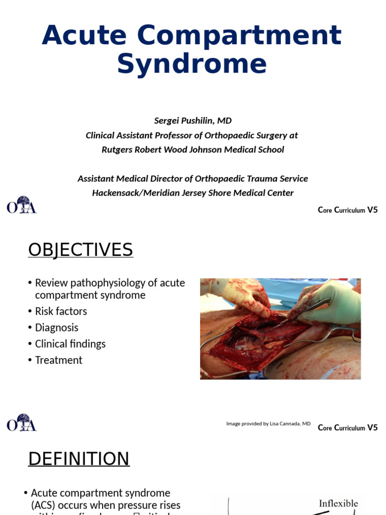 Compartment Syndrome Acute – Syndrome Compartimental Abdominal – OVMN