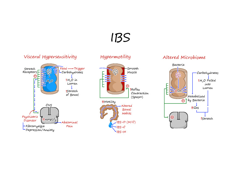 18 - Irritable Bowel Syndrome (Illustrations Key) | PDF