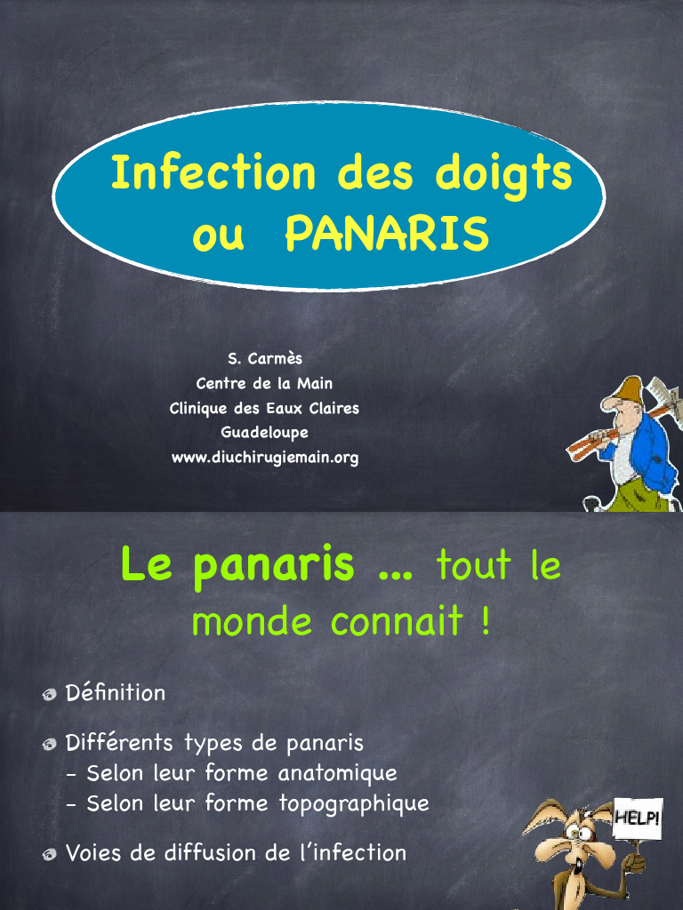 Comprendre le panaris des doigts | PDF | Main | Infection