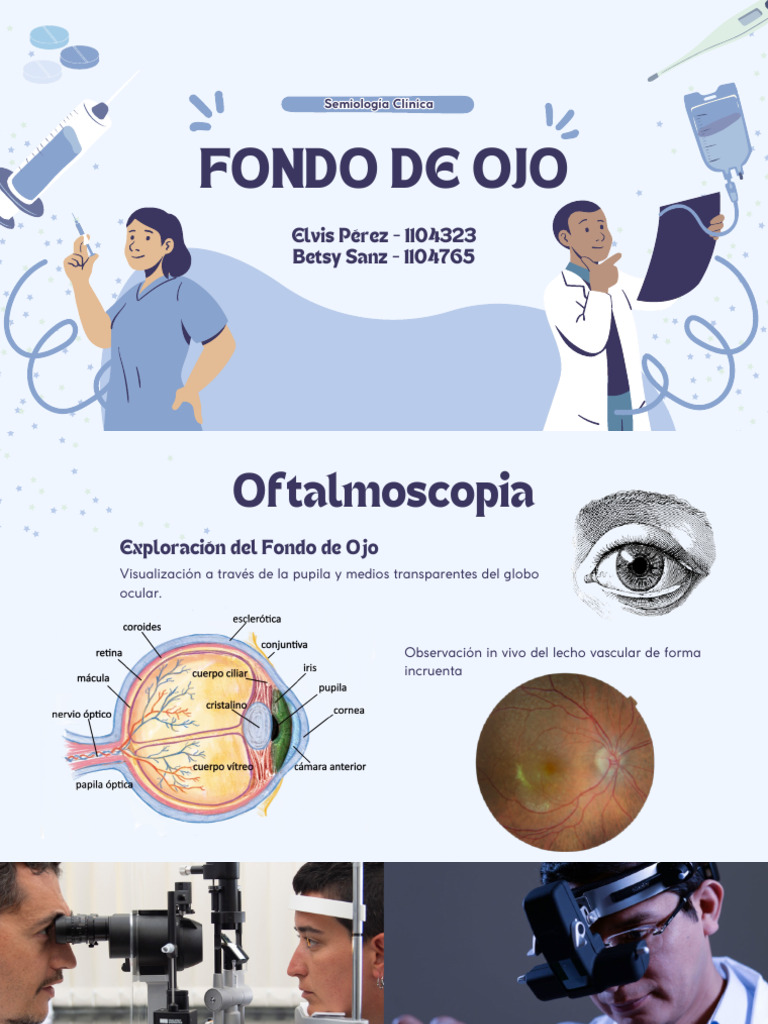 Exploración del Fondo de Ojo en Oftalmoscopia | PDF | Sistema visual ...