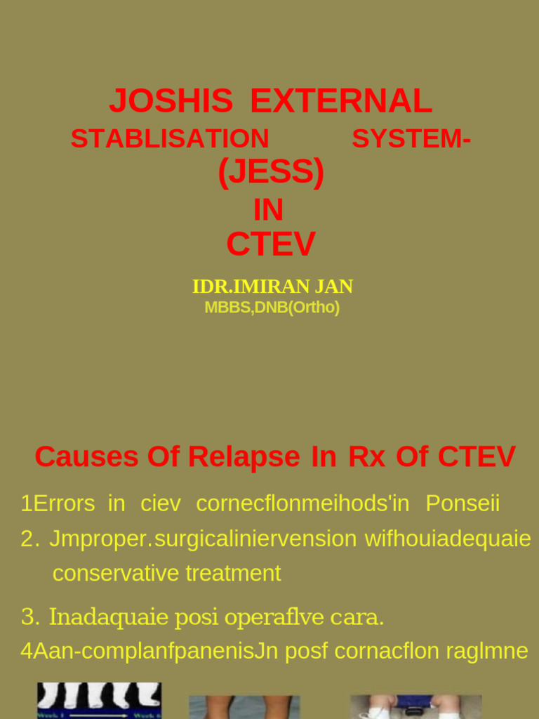Causes of CTEV Relapse and JESS System | PDF | Musculoskeletal System ...