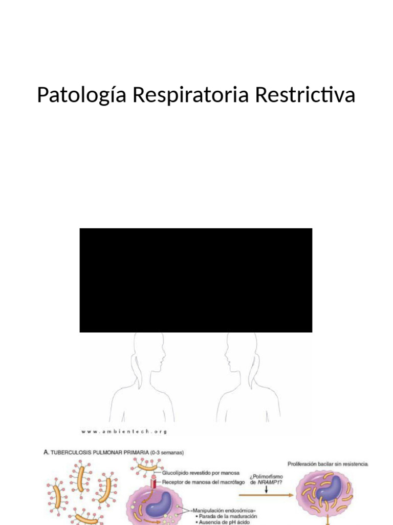 Patología Respiratoria Restrictiva | PDF