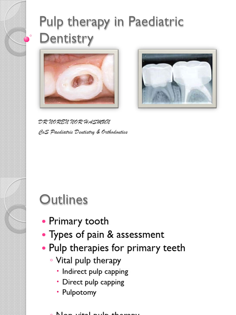 Pulp Therapy in Paediatric Dentistry | PDF | Mouth | Dentistry Branches